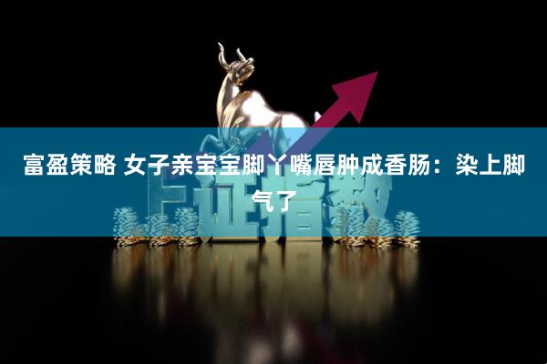 富盈策略 女子亲宝宝脚丫嘴唇肿成香肠：染上脚气了
